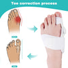 Splint Big Toe Straightener Corrector