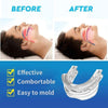 Anti Snoring Bruxism Mouth Guard