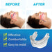 Anti Snoring Bruxism Mouth Guard 
