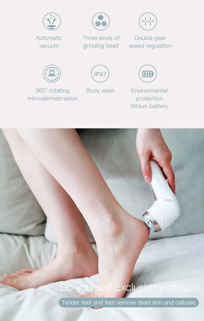 Foot Callus Remover