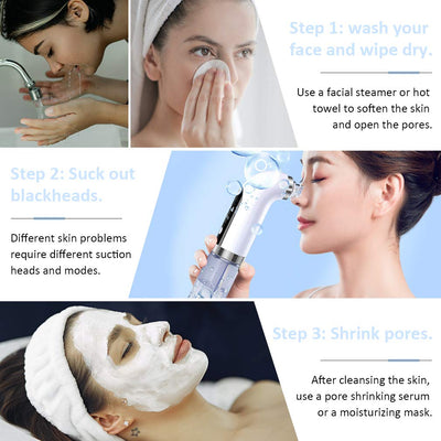 Hydrodermabrasion – Vacuum Blackhead Remover