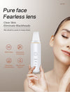 SkinPro™ Ultrasonic Skin Scrubber
