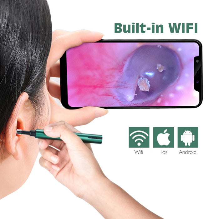 Pro Smart In-Ear Cleaning Endoscope