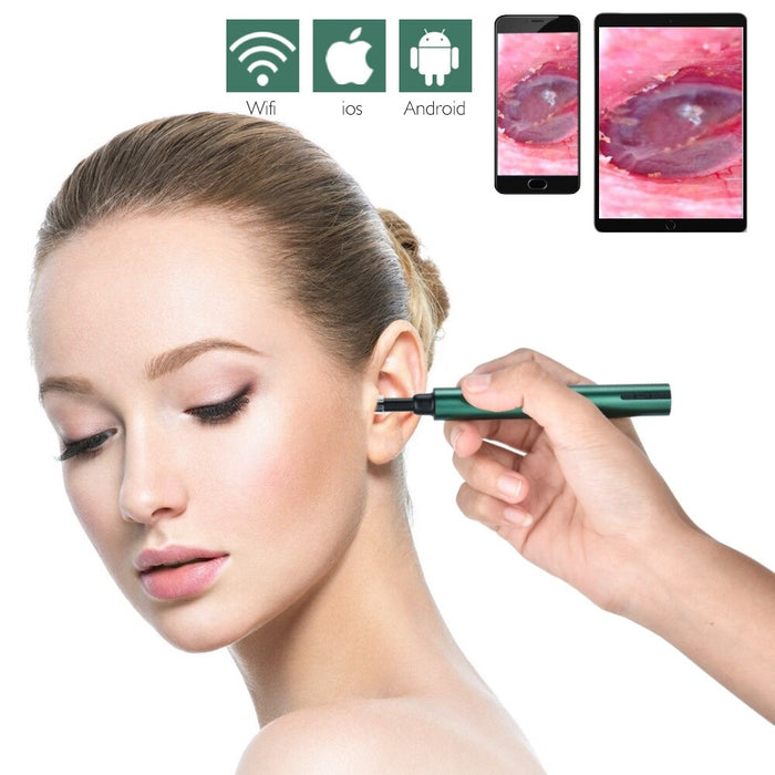 Pro Smart In-Ear Cleaning Endoscope